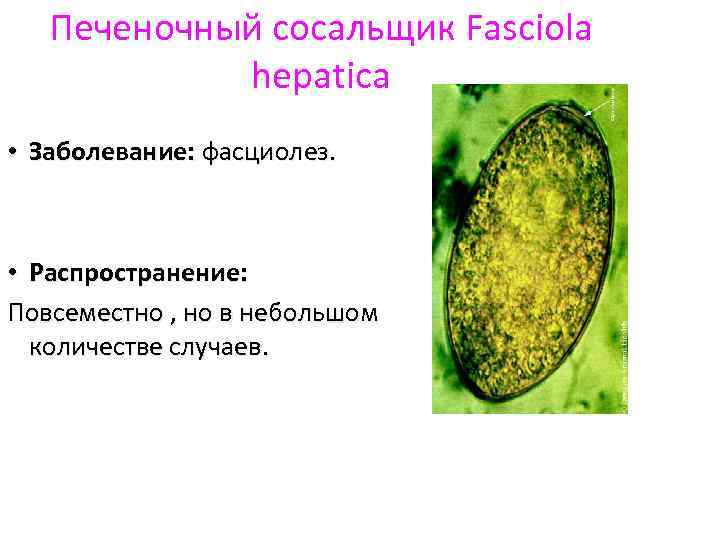 Печеночный сосальщик Fasciolа hеpatica • Заболевание: фасциолез. • Распространение: Повсеместно , но в небольшом