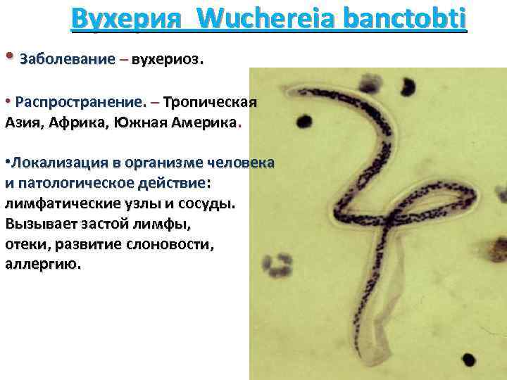 Вухерия Wuchereia banctobti • Заболевание – вухериоз. • Распространение. – Тропическая Азия, Африка, Южная