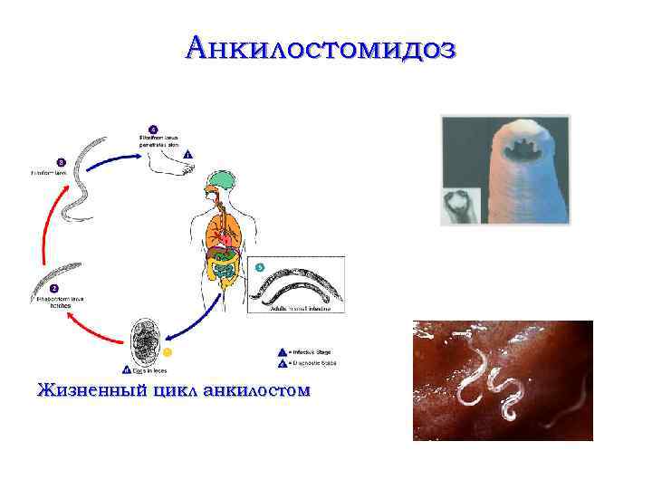 Анкилостомидоз Жизненный цикл анкилостом 