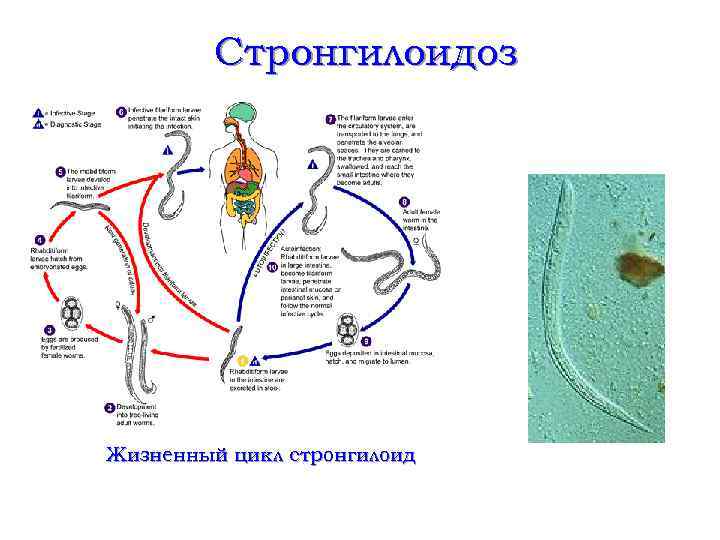 Стронгилоидоз Жизненный цикл стронгилоид 