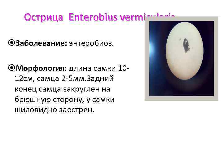 Острица Enterobius vermicularis Заболевание: энтеробиоз. Морфология: длина самки 1012 см, самца 2 -5 мм.