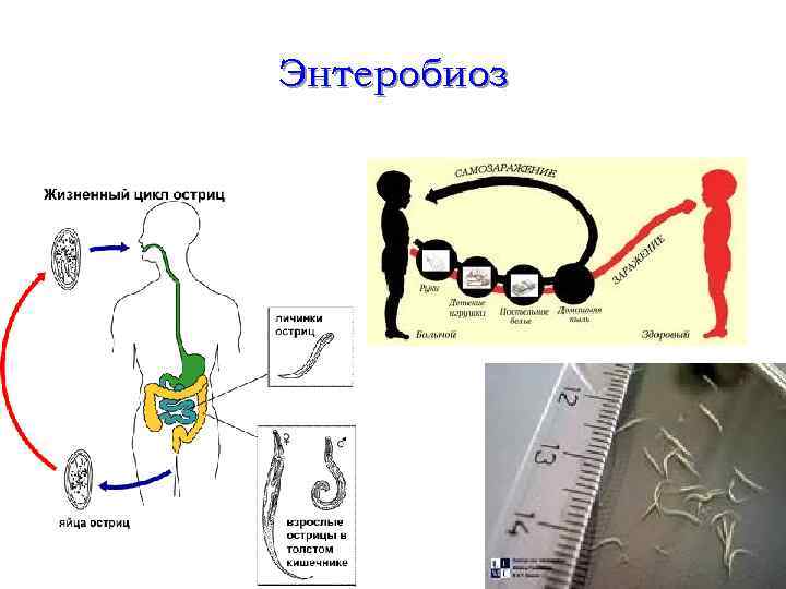 Энтеробиоз 