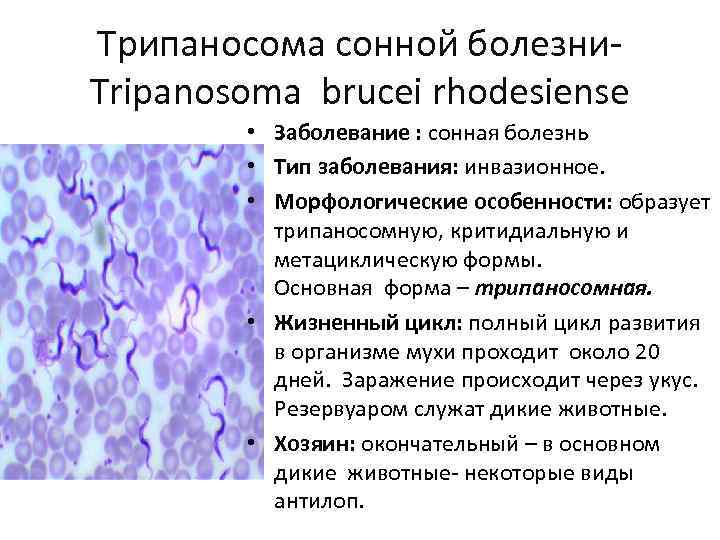 Трипаносома сонной болезни. Tripanosoma brucei rhodesiense • Заболевание : сонная болезнь • Тип заболевания: