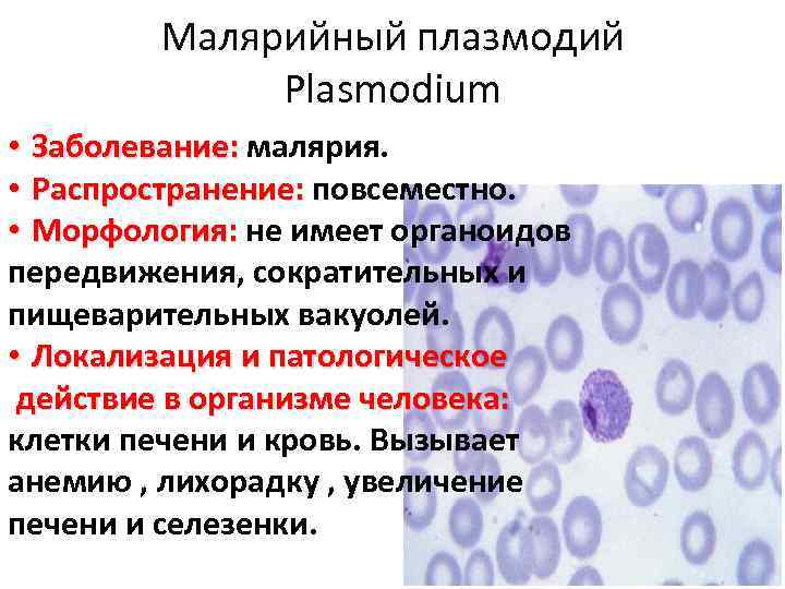 Малярийный плазмодий Plasmodium • Заболевание: малярия. • Распространение: повсеместно. • Морфология: не имеет органоидов