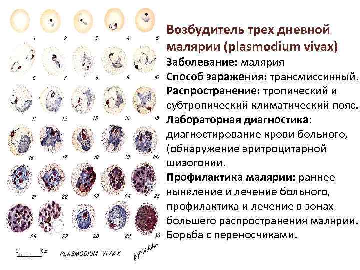 Возбудитель трех дневной малярии (plasmodium vivax) Заболевание: малярия Способ заражения: трансмиссивный. Распространение: тропический и