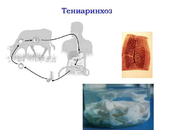 Тениаринхоз 