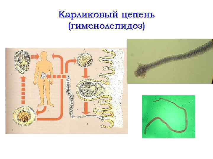 Карликовый цепень (гименолепидоз) 