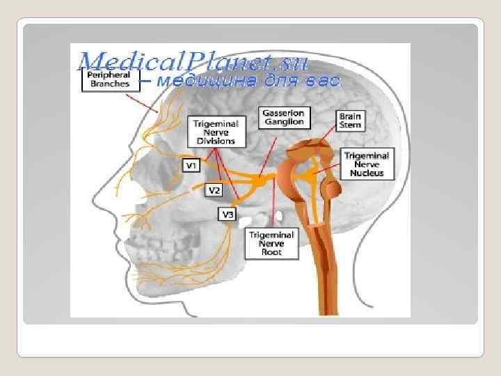 Слуховой нерв какой отдел. Слуховой нерв строение. Где находится слуховой нерв у человека. Невринома преддверно-улиткового (VIII) нерва.