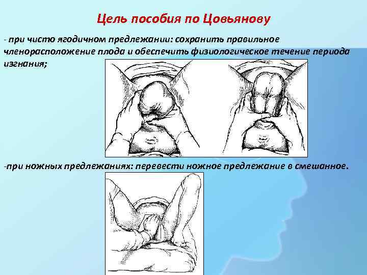 Этапы родов с картинками