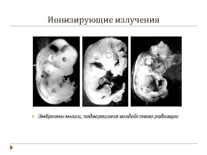 Ионизирующие излучения Эмбрионы мыши, подвергшиеся воздействию радиации 