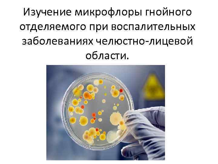 Изучение микрофлоры гнойного отделяемого при воспалительных заболеваниях челюстно-лицевой области. 