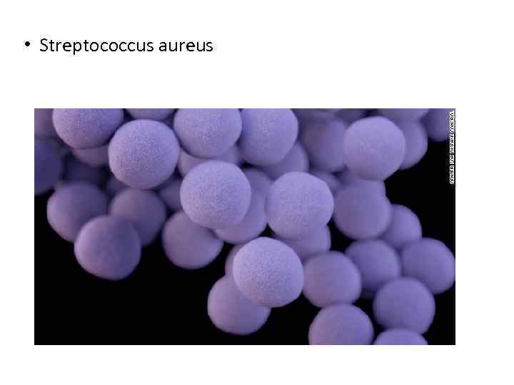  • Streptococcus aureus 