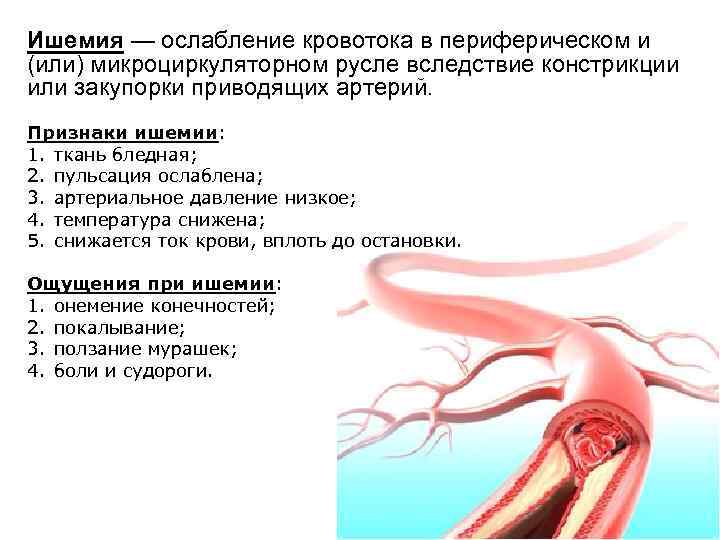 Ишемия — ослабление кровотока в периферическом и (или) микроциркуляторном русле вследствие констрикции или закупорки