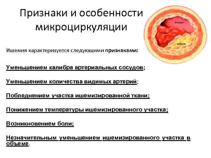 Признаки и особенности микроциркуляции Ишемия характеризуется следующими признаками: Уменьшением калибра артериальных сосудов; Уменьшением количества