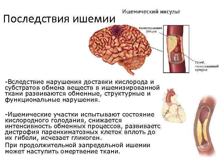 Последствия ишемии -Вследствие нарушения доставки кислорода и субстратов обмена веществ в ишемизированной ткани развиваются