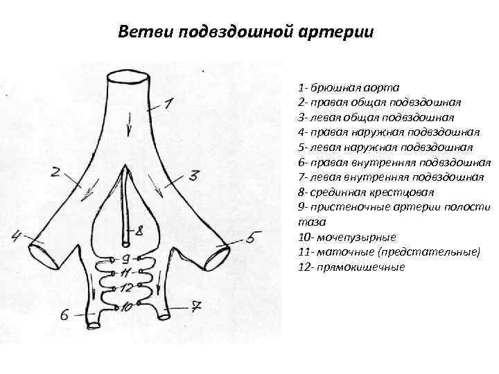 Ветви подвздошной артерии 1 - брюшная аорта 2 - правая общая подвздошная 3 -