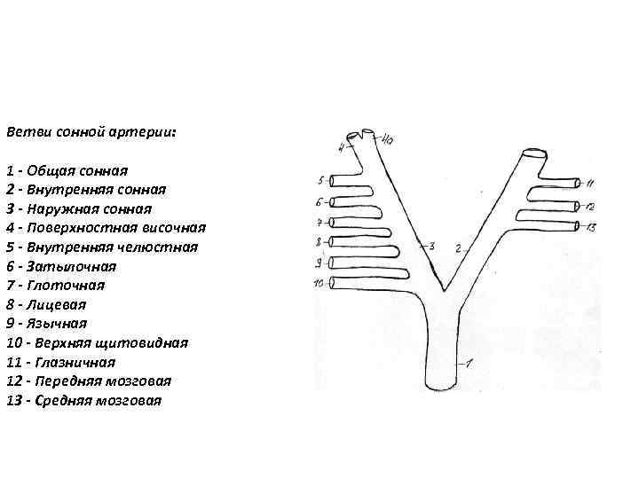 Ветви сонной артерии: 1 - Общая сонная 2 - Внутренняя сонная 3 - Наружная