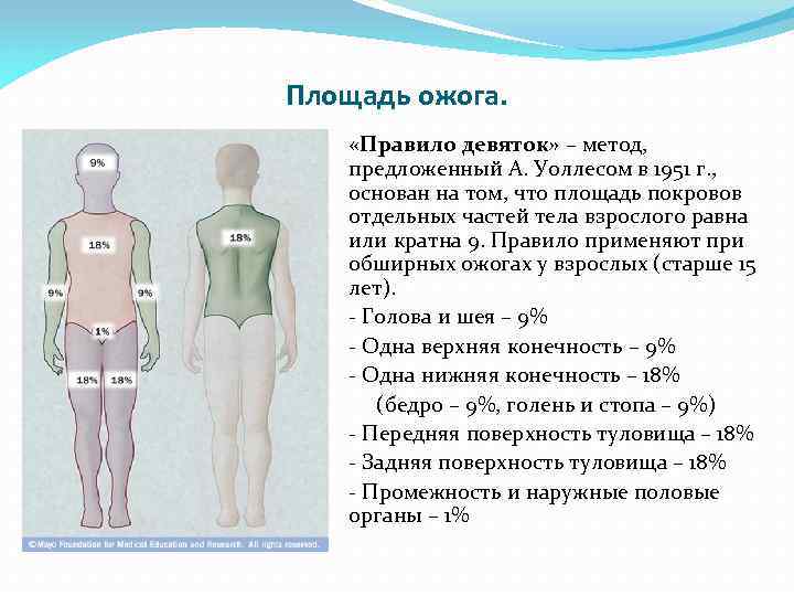 Площадь ожога. «Правило девяток» – метод, предложенный А. Уоллесом в 1951 г. , основан