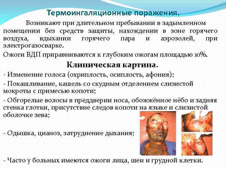 Термоингаляционные поражения. Возникают при длительном пребывании в задымленном помещении без средств защиты, нахождении в