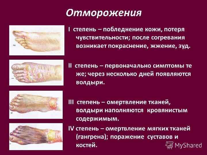 Карта интенсивной терапии реанимации