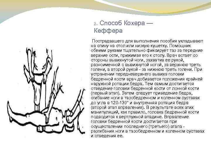 . Способ Кохера — Кеффера 2 Пострадавшего для выполнения пособия укладывают на спину на