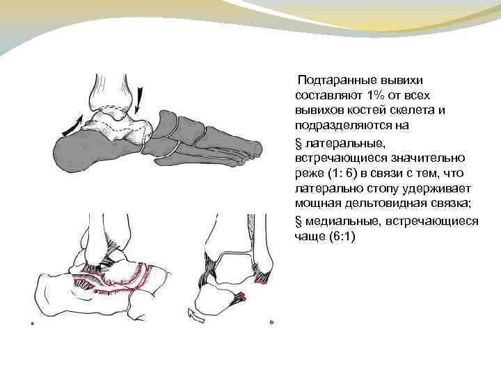 Вывих стопы карта вызова