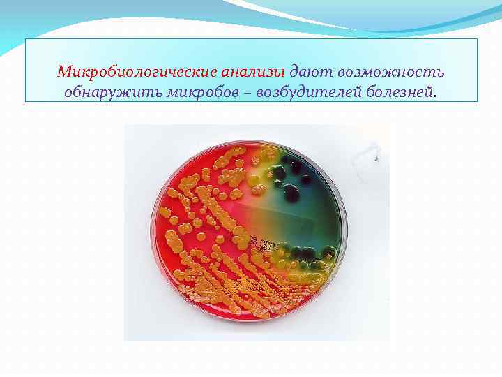 Микробиологические анализы дают возможность обнаружить микробов – возбудителей болезней. 