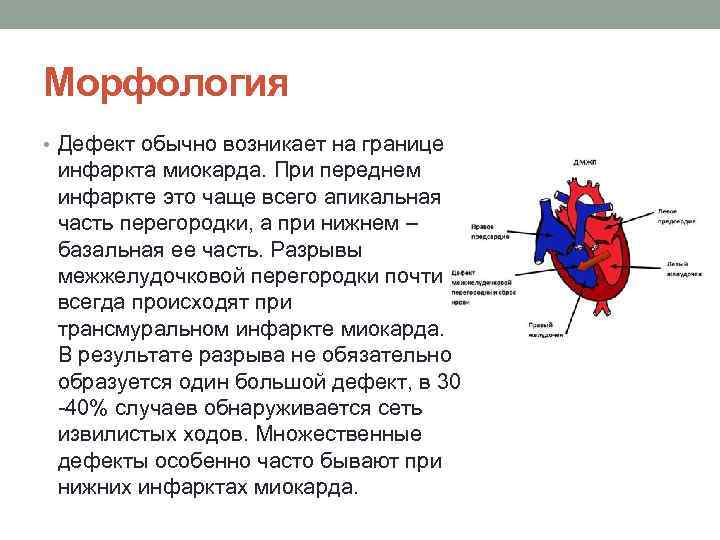 Нарушение стенки миокарда