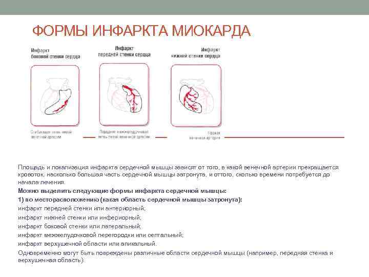 ФОРМЫ ИНФАРКТА МИОКАРДА Площадь и локализация инфаркта сердечной мышцы зависят от того, в какой
