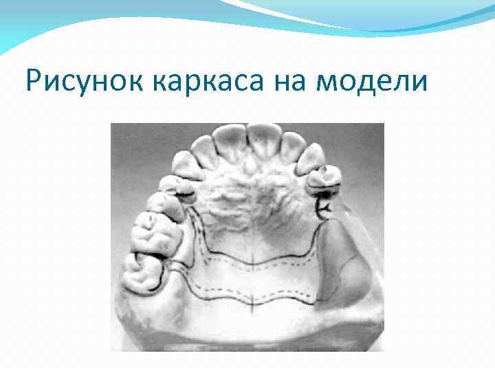 Рисунок каркаса на модели 