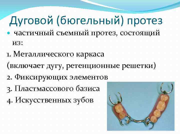 Дуговой (бюгельный) протез частичный съемный протез, состоящий из: 1. Металлического каркаса (включает дугу, ретенционные