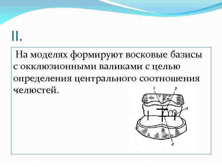 Изготовление воскового базиса с окклюзионными валиками презентация