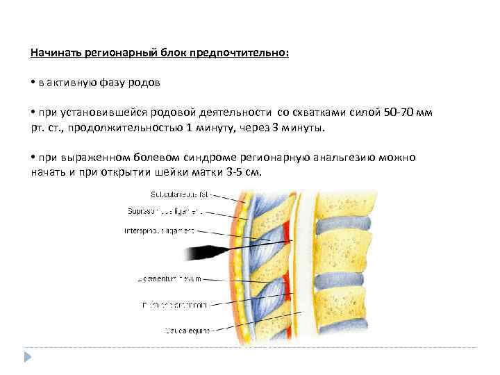 Начинать регионарный блок предпочтительно: • в активную фазу родов • при установившейся родовой деятельности