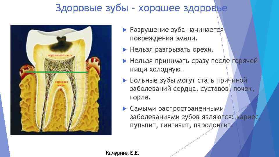 Здоровые зубы – хорошее здоровье Разрушение зуба начинается повреждения эмали. Нельзя разгрызать орехи. Нельзя