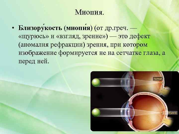 Миопия. • Близору кость (миопи я) (от др. греч. — «щурюсь» и «взгляд, зрение»