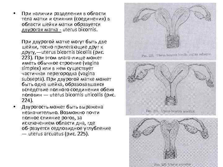  • • При наличии разделения в области тела матки и слияния (соединения) в
