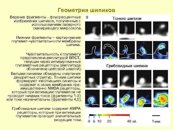 Геометрия шипиков Верхние фрагменты - флуоресцентные изображения шипиков, полученные с использованием лазерного сканирующего микроскопа.