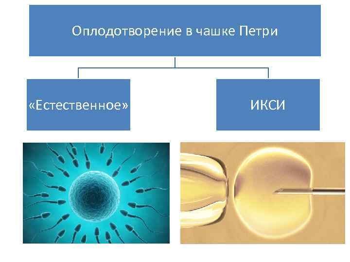 Оплодотворение в чашке Петри «Естественное» ИКСИ 