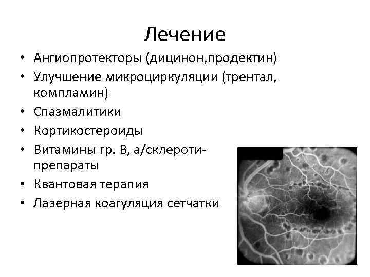 Лечение • Ангиопротекторы (дицинон, продектин) • Улучшение микроциркуляции (трентал, компламин) • Спазмалитики • Кортикостероиды