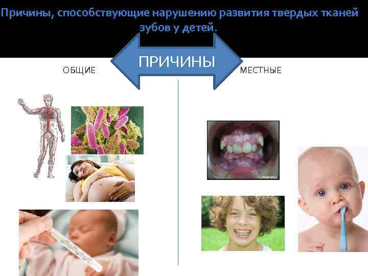 Причины, способствующие нарушению развития твердых тканей зубов у детей. ОБЩИЕ ПРИЧИНЫ МЕСТНЫЕ 