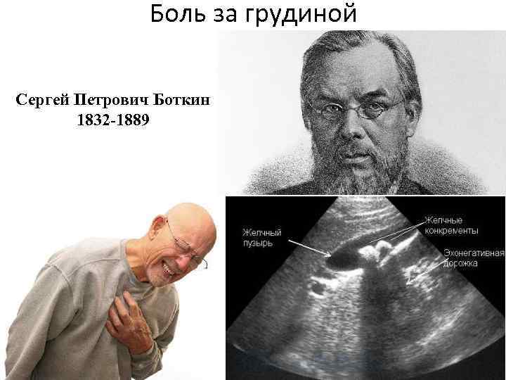 Боль за грудиной Сергей Петрович Боткин 1832 -1889 