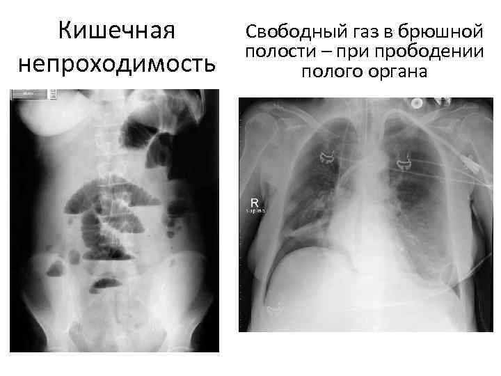 Полость свободно