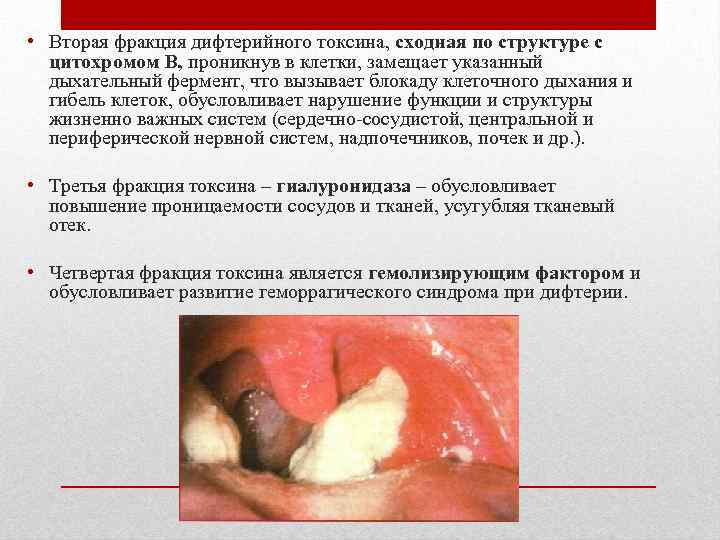  • Вторая фракция дифтерийного токсина, сходная по структуре с цитохромом В, проникнув в