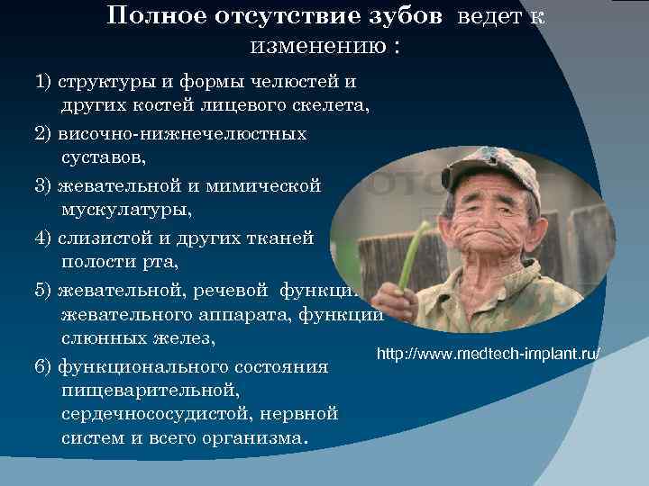 Полное отсутствие