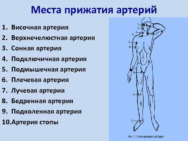 Сколько всего точек прижатия артерий. Точки прижатия артерий для остановки кровотечения. Места прижатия артерий. Места пальцевого прижатия артерий. Место придатия артерий.