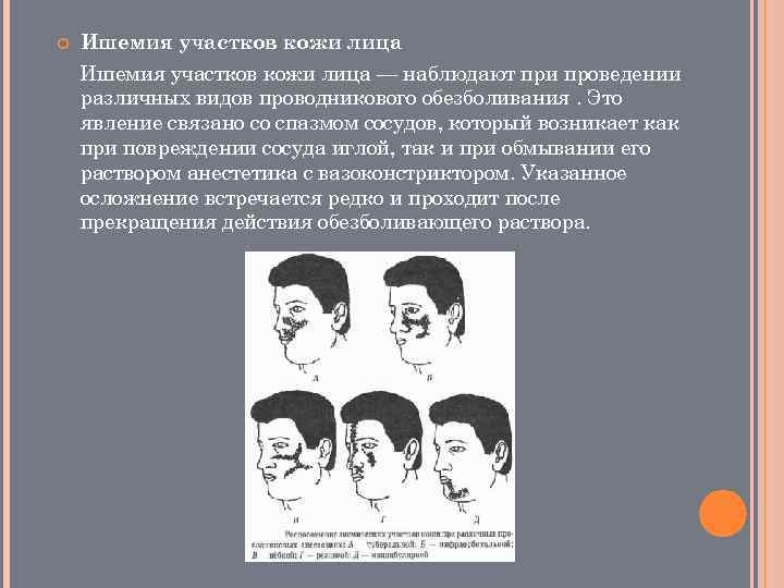  Ишемия участков кожи лица — наблюдают при проведении различных видов проводникового обезболивания. Это