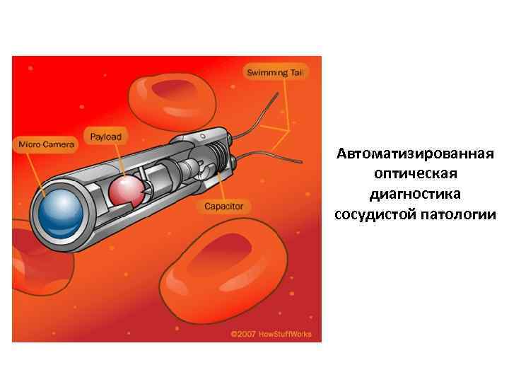 Автоматизированная оптическая диагностика сосудистой патологии 