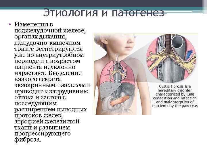 Этиология и патогенез • Изменения в поджелудочной железе, органах дыхания, желудочно-кишечном тракте регистрируются уже