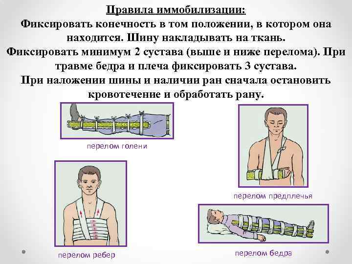 Правила иммобилизации: Фиксировать конечность в том положении, в котором она находится. Шину накладывать на