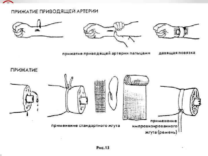 Как остановить кровотечение дюфастоном схема